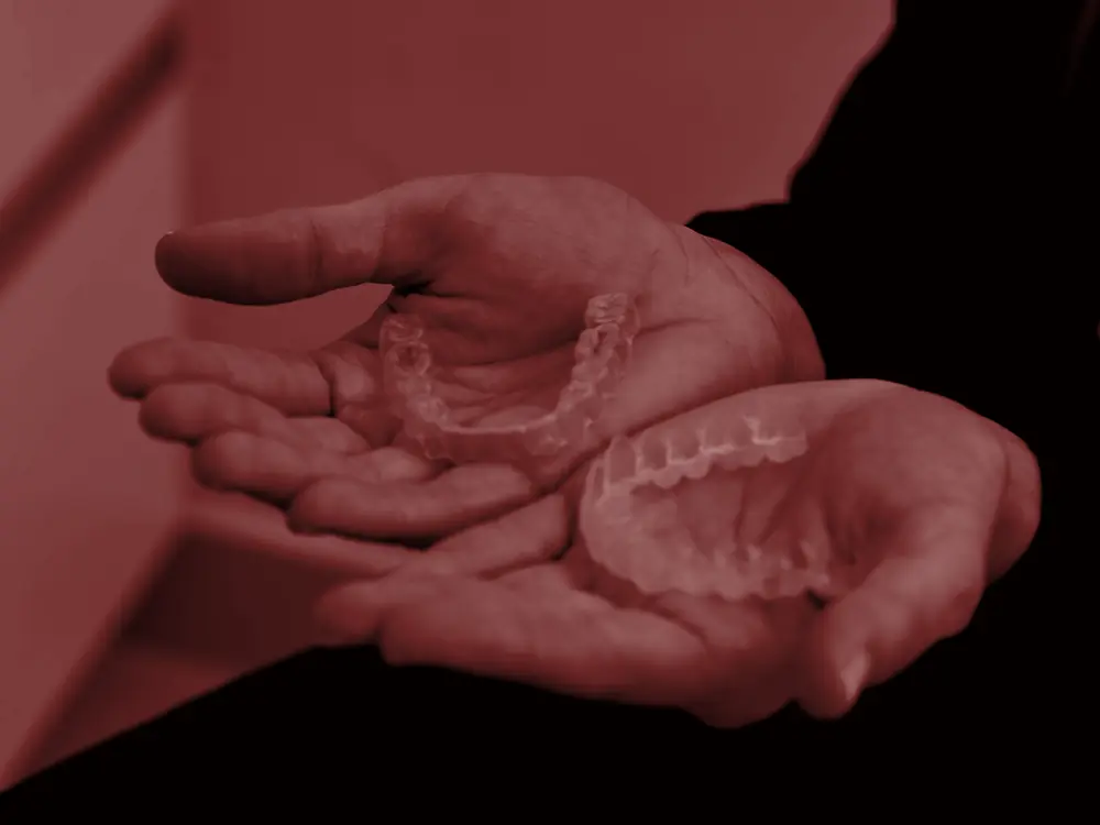 Clear aligner trays held in open hands