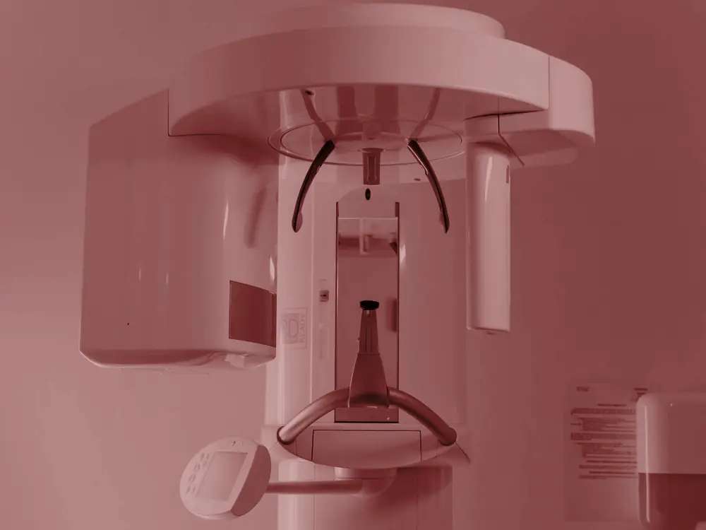 Dental CBCT scanner used for 3D x-ray imaging