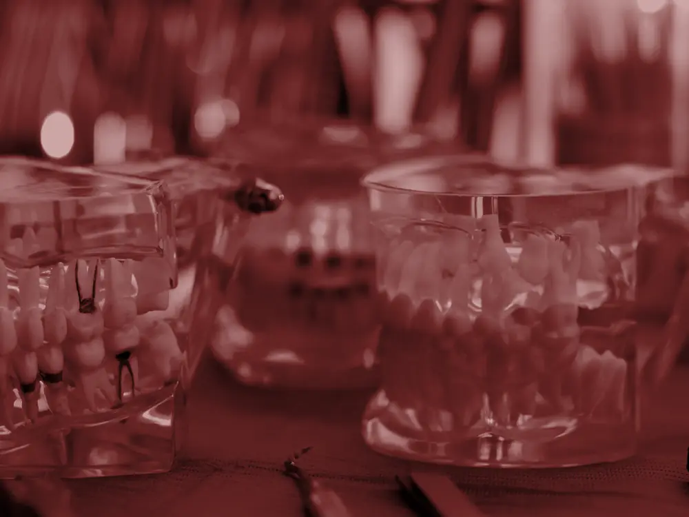 Clear plastic jaw models on a dental workbench