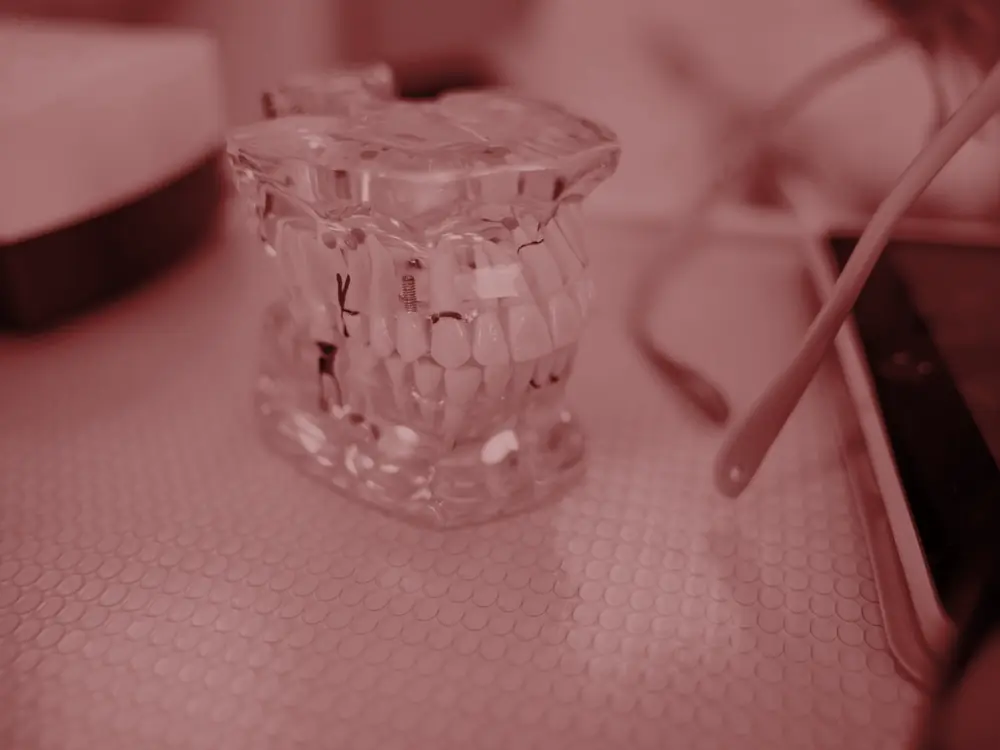 Clear jaw model on a desk beside dental equipment