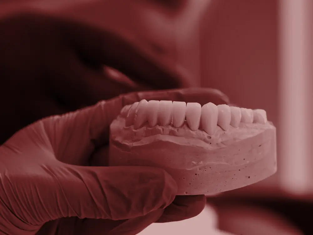 Blue gloved hand holding a dental model of the teeth