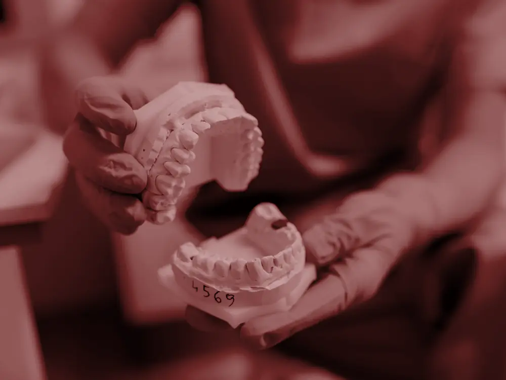 Gloved hands holding a dental model in a clinic
