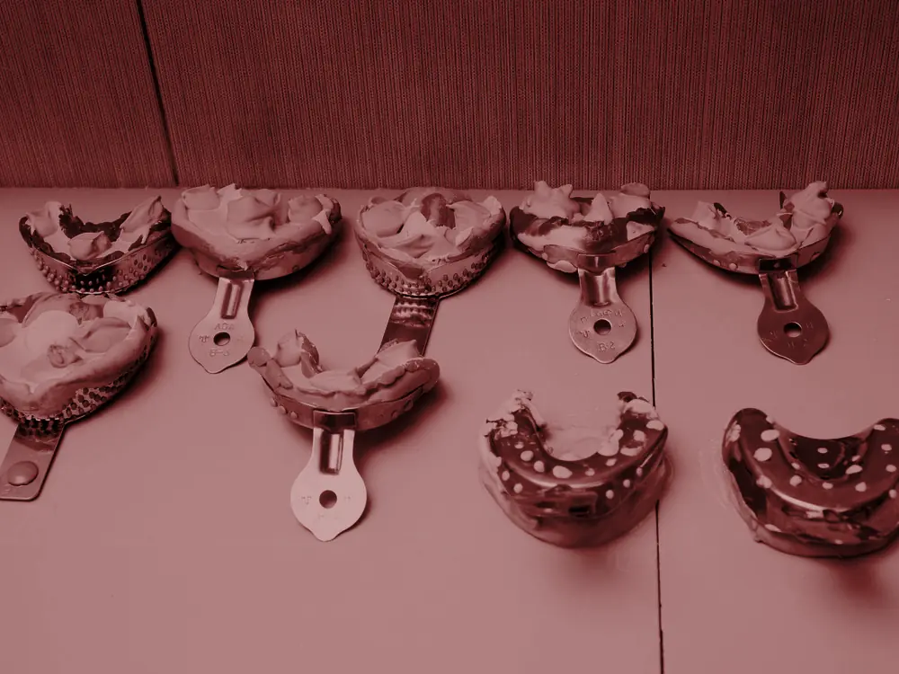 Row of dental impression trays with impressions