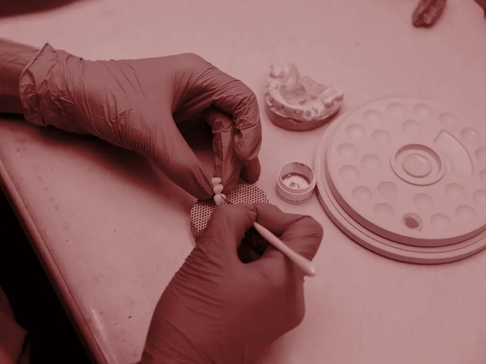 Gloved hands working on a dental model in the laboratory