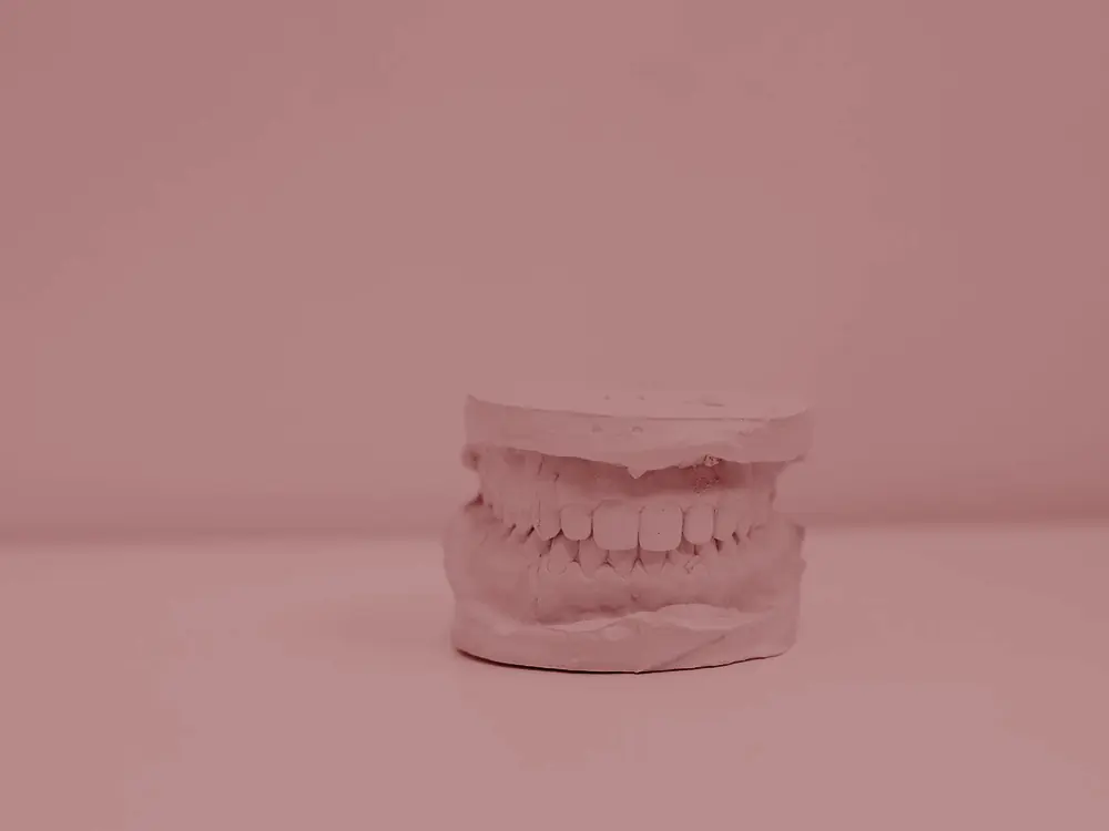 Plaster dental model of the upper and lower teeth on a white surface