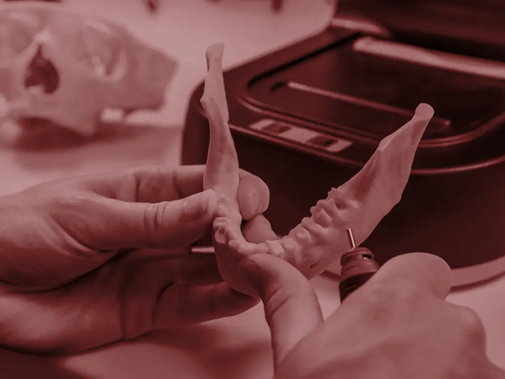 3D printed jaw model being checked by hand