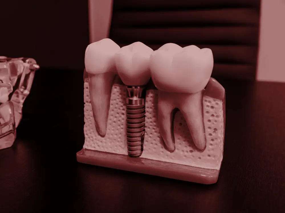 Large model of a tooth showing the crown and roots