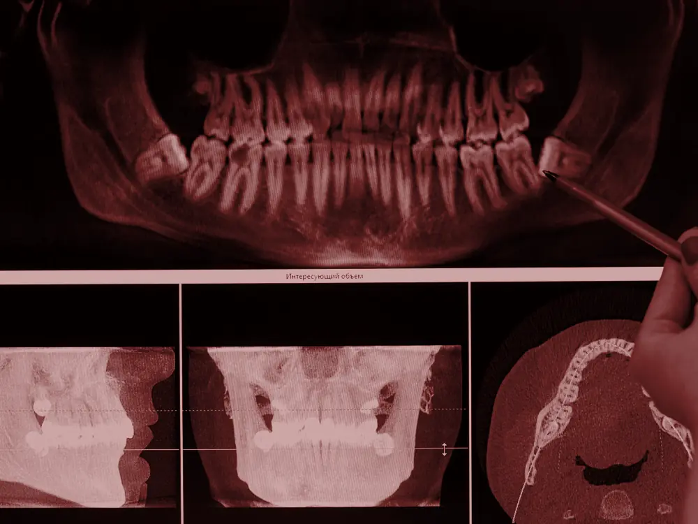 Printed panoramic and 3D dental x-ray images